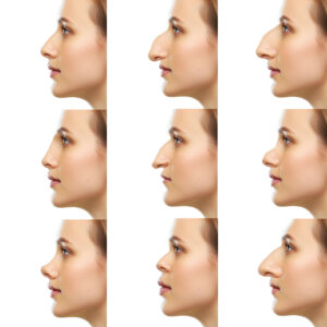 Les 9 formes de nez